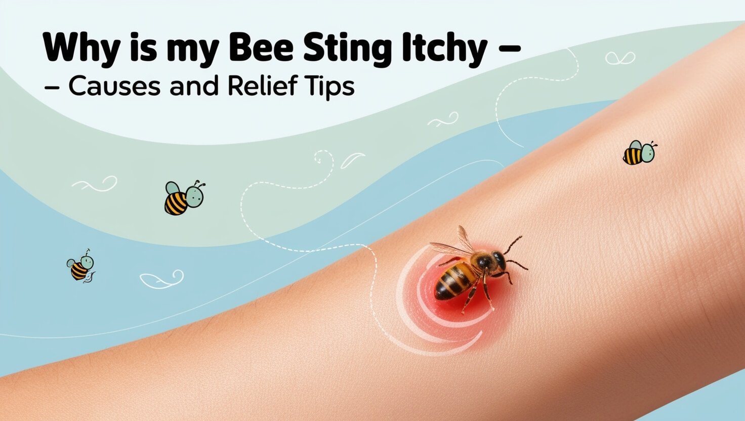 Why Is My Bee Sting Itchy - Causes and Relief Tips